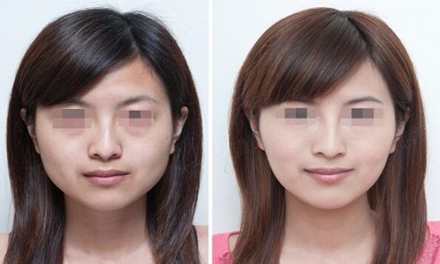 煙臺(tái)市三甲整形醫(yī)院排名匯總，哪家好？