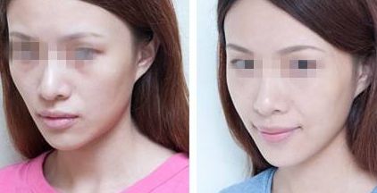 杭州治療耳矯正的專業(yè)醫(yī)院排行榜