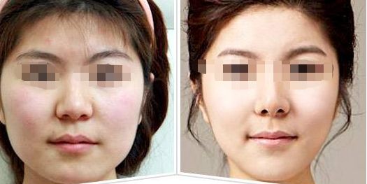 2024年廣州醫(yī)美整形醫(yī)院排行榜領(lǐng)軍十強(qiáng)