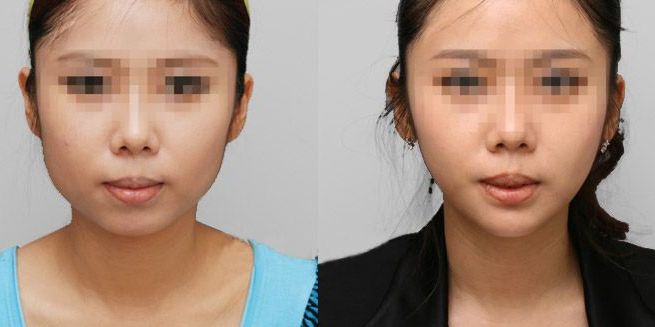 蘭州哪家整形醫(yī)院口碑好？看看排名榜單！