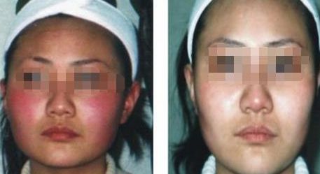 蘇州雙眼皮醫(yī)院排行榜，哪所醫(yī)院技術(shù)靠譜