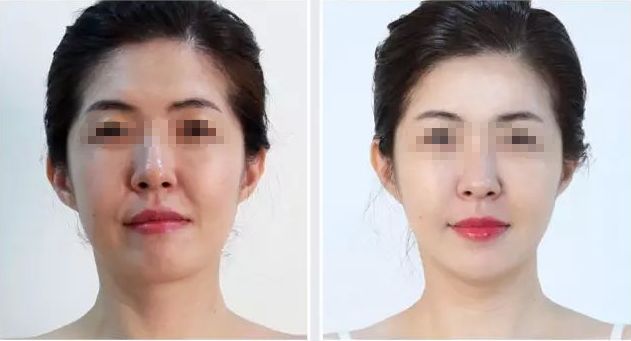 濟(jì)寧哪家整形醫(yī)院評價好，口碑排名靠前的有哪些？