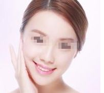 揭秘昆明消褪淚痕神器：十家除淚溝醫(yī)院大橫評(píng)