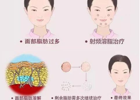 徐州二院整形美容科專家評價及服務(wù)項目介紹，陶常波醫(yī)生特長領(lǐng)域一覽