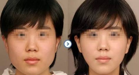 【揭秘】合肥私立整形醫(yī)院人氣TOP榜單！