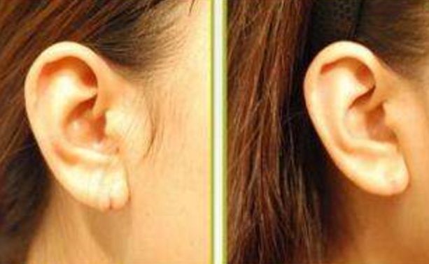 朝陽地區(qū)整形醫(yī)院豐胸治療價格查詢