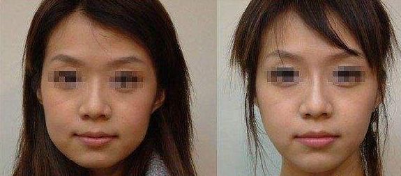 沈陽哪家整形醫(yī)院好評排行榜