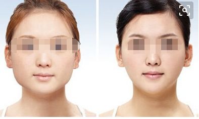 濟南減肥醫(yī)院有哪些？