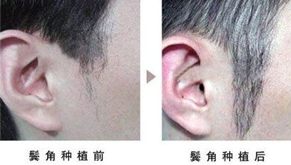 熱瑪吉第四代和第五代差異及價(jià)格指南