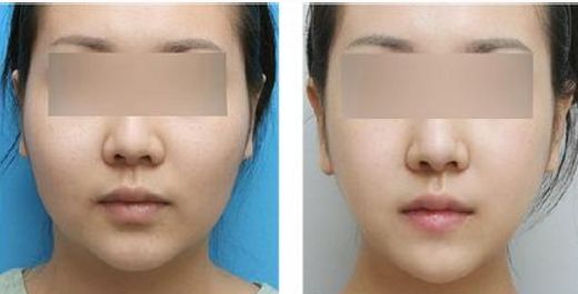 云南優(yōu)秀的洗紋身整形醫(yī)院排名榜TOP10