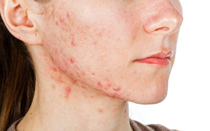 杭州美聯(lián)致美整形醫(yī)院-醫(yī)生介紹、口碑評價及價格解讀