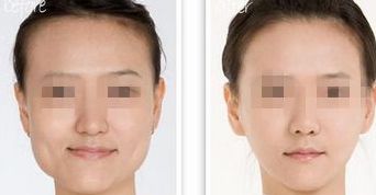 黑龍江三甲整形醫(yī)院熱門榜單，前三強(qiáng)大揭秘！