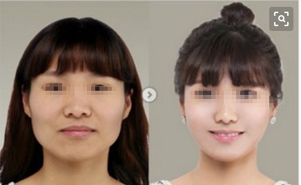 梅州皇佳貝麗整形醫(yī)院2023全新提升，醫(yī)療技術(shù)引領(lǐng)新潮流