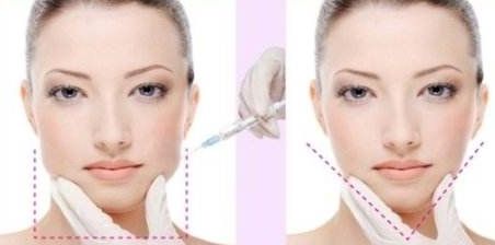 麗水市人民醫(yī)院整形外科可信賴嗎？詳細資料+收費明細，快來了解！