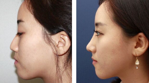 呼和浩特整形醫(yī)院排名大揭秘，了解哪家更靠譜！