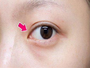 揚(yáng)州哪家整形醫(yī)院技術(shù)好？