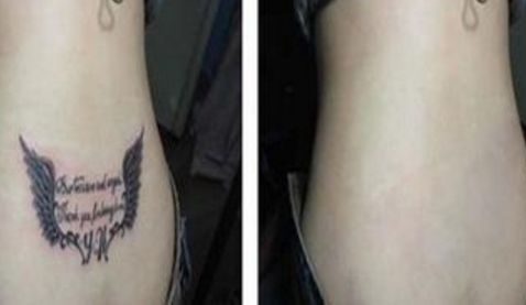 雙眼皮手術(shù)醫(yī)院推薦，一站式解決開眼角問題