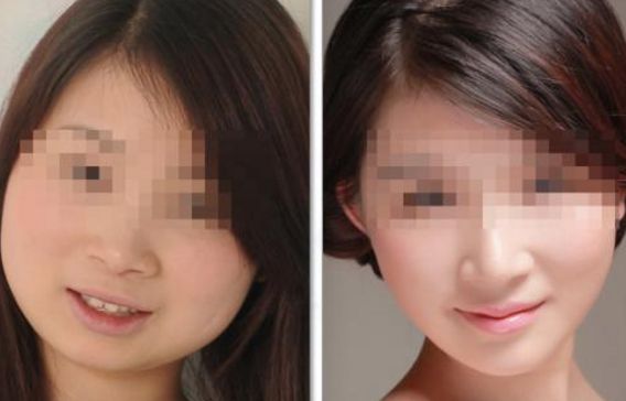 洛陽哪家醫(yī)學(xué)美容院眉部整形技術(shù)頂尖