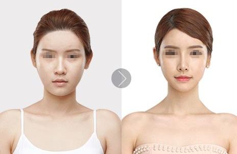 上海整形醫(yī)院排行榜：十家獨特選擇，追求美麗者歡聚一堂！