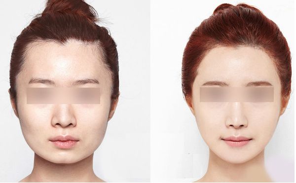 哈爾濱微整形醫(yī)院榜單發(fā)布，全面揭秘哪家醫(yī)院更受歡迎