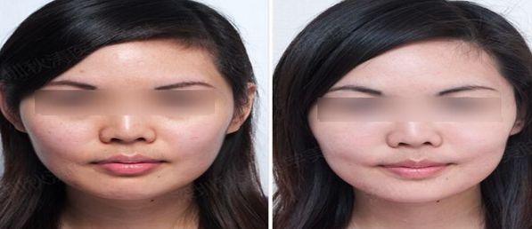 北京醫(yī)美行業(yè)領(lǐng)先者揭曉，排名前十大公示