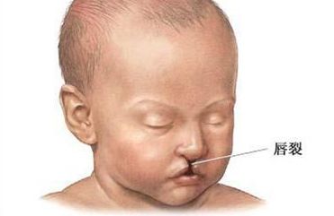 內(nèi)蒙古附屬醫(yī)院點陣激光體驗分享，了解一下這項先進技術吧！價格表附后！