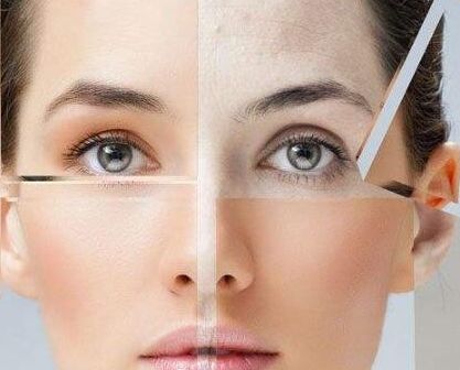 11月16日，喬雅登緹顏國(guó)內(nèi)首發(fā)發(fā)布會(huì)震撼北京，沈陽(yáng)百嘉麗首發(fā)力挺