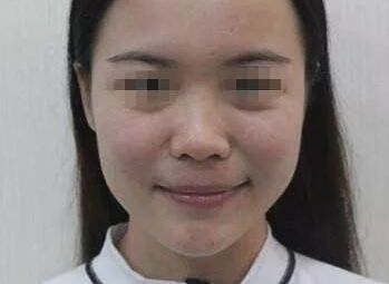 南充疤痕整形醫(yī)院排名精選，助你尋找完美去疤痕之旅