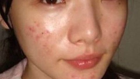 北京眼科醫(yī)院排名榜單揭曉，何氏、同仁入選！附近視眼手術費用一覽