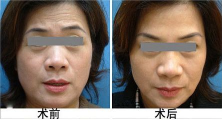 常州哪家唇部整形醫(yī)院值得信賴，價(jià)格如何？