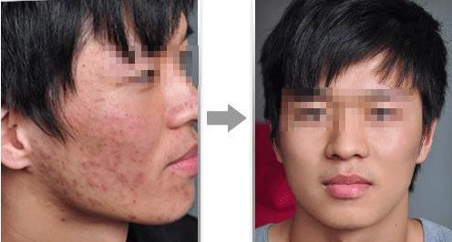 濟(jì)南高新麥昆醫(yī)療美容診所的價(jià)格如何？真實(shí)技術(shù)測(cè)評(píng)與大揭秘