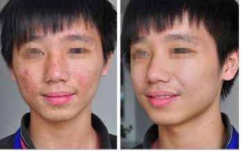 浙江很受歡迎的整形醫(yī)院名單公布