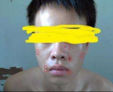 ?？谑笳吾t(yī)院匯總，哪家效果比較好？