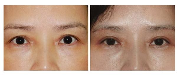 廣州整形醫(yī)院排名：領(lǐng)銜藝美、威利斯、美涵！