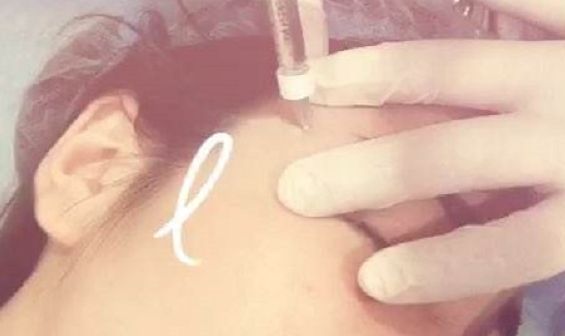 深圳前海地區(qū)哪家整形醫(yī)院比較靠譜？好的深圳整容醫(yī)院有哪些？