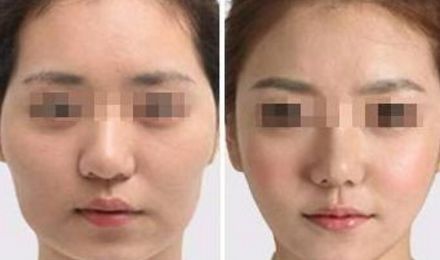 江蘇地區(qū)更受歡迎的整形醫(yī)院排行榜發(fā)布