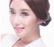 2024年太原頂級整形醫(yī)院排名曝光，專家評選出的前10強！