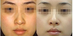 成都珀媛醫(yī)療美容服務(wù)水平如何？醫(yī)院介紹及費(fèi)用大公開