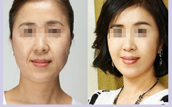 溫州哪家整形醫(yī)院口碑好？排名榜單揭曉