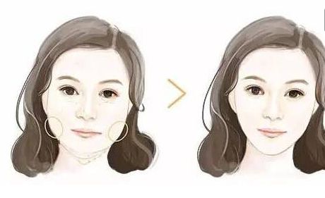 2024年最佳匯總！惠州哪家整形醫(yī)院專業(yè)祛法令紋？