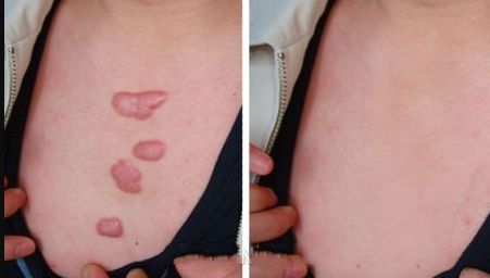 北京有哪些三甲級(jí)美容醫(yī)院？