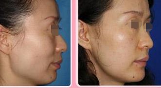 北京整形醫(yī)院推薦匯總