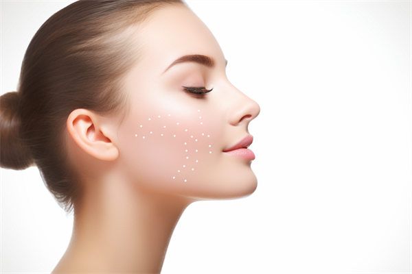 沈陽(yáng)伊美爾超聲吸脂雙下巴效果全解析