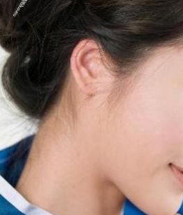 成都哪個醫(yī)院做耳朵整形效果好？