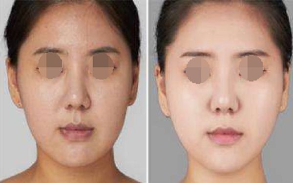 珠海博愛女子醫(yī)院整形外科項目全新推出，項目大揭秘