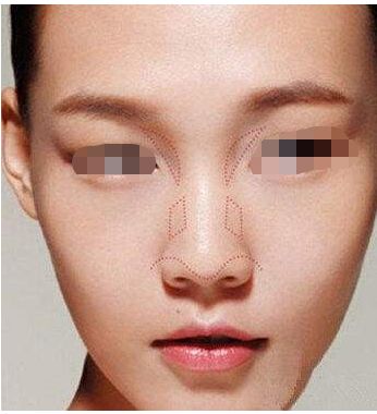 泉州哪些醫(yī)院可以信賴進行整形手術(shù)？