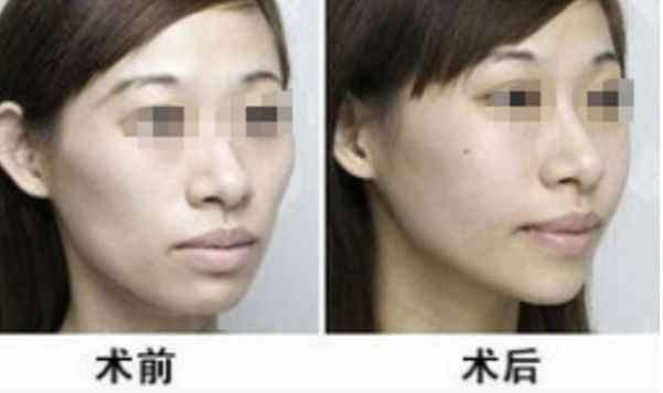 湖北地區(qū)整形醫(yī)院評選榜單，醫(yī)術(shù)高超排名靠前的醫(yī)療機(jī)構(gòu)