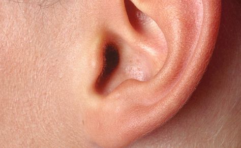 鄭州人民醫(yī)院眼袋手術價格及費用參考