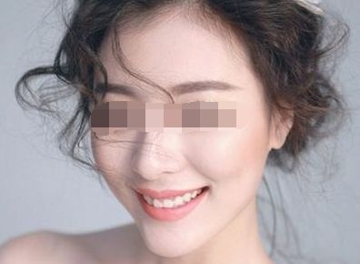 上海十大修復(fù)雙眼皮專家排行榜