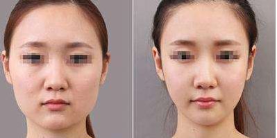 2024年北京八大處整形手術(shù)價格明細(xì)和推薦專家名錄